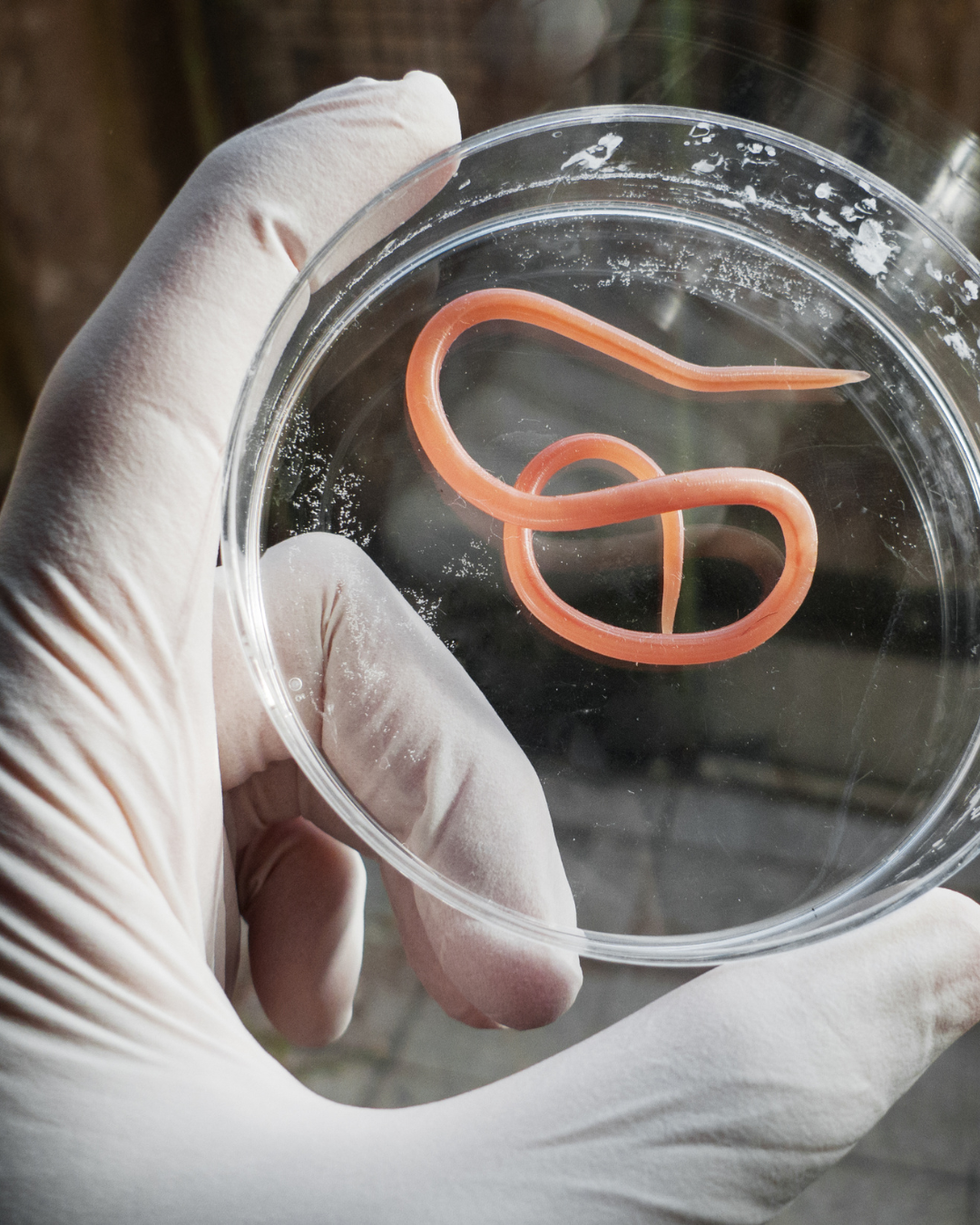 ¿Qué son los parásitos intestinales y cómo afectan tu salud?
