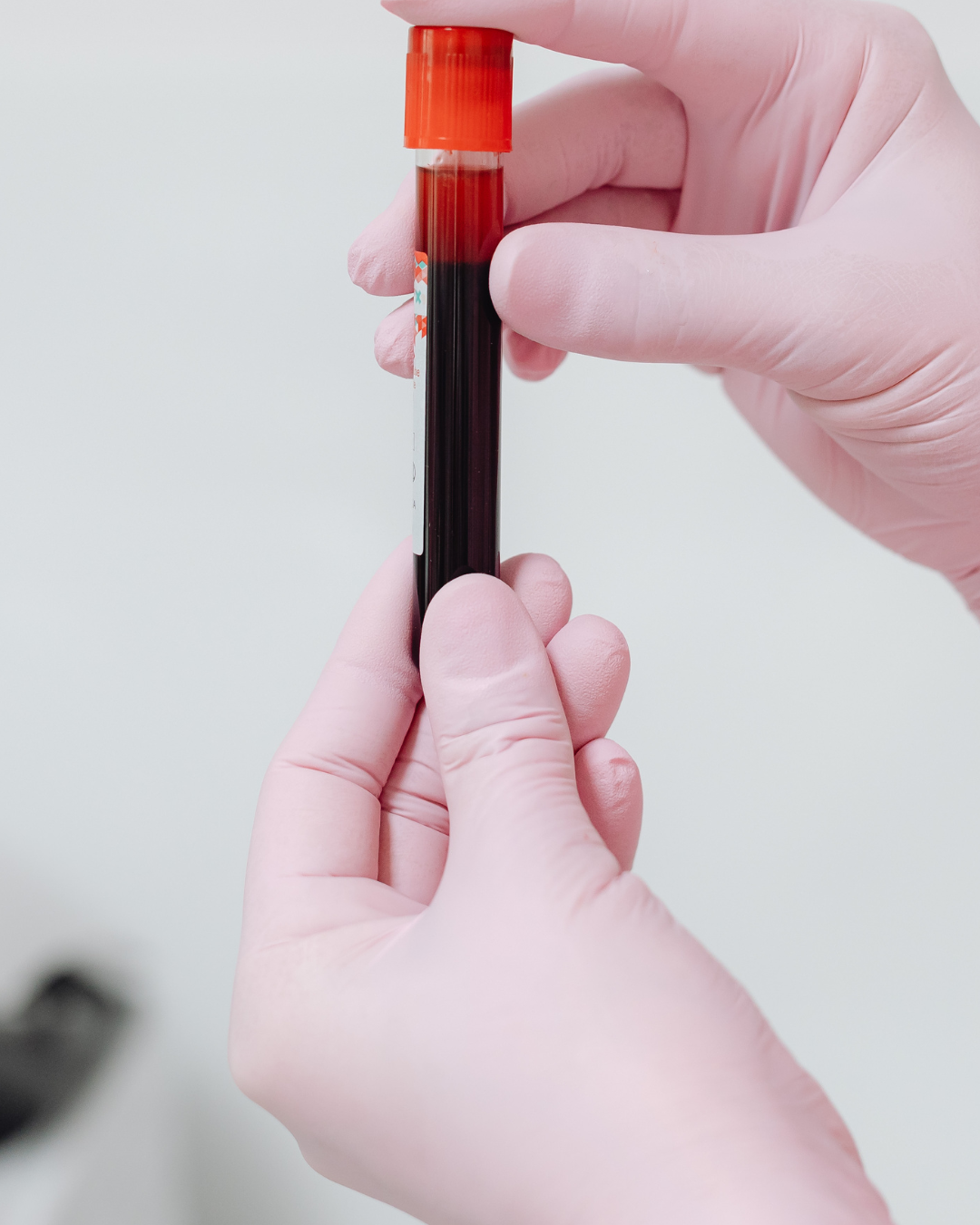 Ferritina baja y anemia: nuevas guías 2026, causas y cómo subir el hierro correctamente